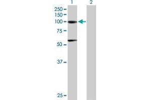 Western Blot analysis of ACO1 expression in transfected 293T cell line by ACO1 MaxPab polyclonal antibody. (Aconitase 1 Antikörper  (AA 1-889))