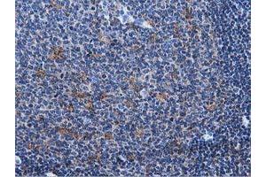 Immunohistochemical staining of paraffin-embedded Human lymph node tissue using anti-MICAL1 mouse monoclonal antibody. (MICAL1 Antikörper)