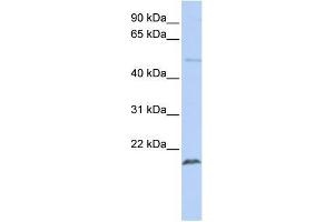 Human Jurkat; WB Suggested Anti-ZNF79 Antibody Titration: 0. (ZNF79 Antikörper  (N-Term))