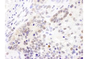 Immunohistochemistry (IHC) image for anti-Cullin 4B (CUL4B) (AA 863-913) antibody (ABIN7454566) (Cullin 4B Antikörper  (AA 863-913))