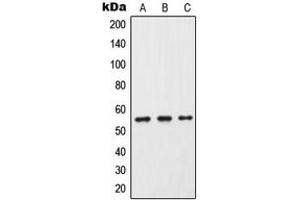 Western blot analysis of Cytochrome P450 2C9 expression in HeLa (A), Raw264. (CYP2C9 Antikörper  (Center))