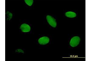 Immunofluorescence of purified MaxPab antibody to CHD2 on HeLa cell. (CHD2 Antikörper  (AA 1-501))