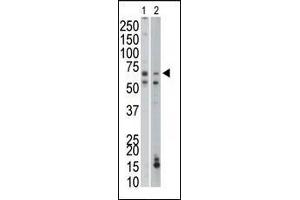 The anti-PCK1 Pab (ABIN1882180 and ABIN2842170) is used in Western blot to detect PCK1 in mouse liver (Lane 1) and mouse small intestine tissue lysates (Lane 2). (PCK1 Antikörper  (C-Term))