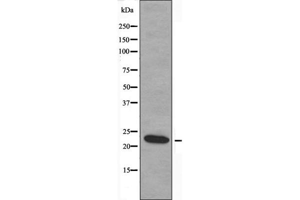MOBKL2B Antikörper  (C-Term)