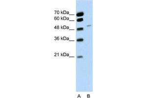 Western Blotting (WB) image for anti-RNA Binding Motif Protein 22 (RBM22) antibody (ABIN2462277) (RBM22 Antikörper)