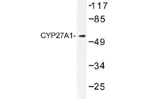 Image no. 1 for anti-Cytochrome P450, Family 27, Subfamily A, Polypeptide 1 (CYP27A1) antibody (ABIN272272) (CYP27A1 Antikörper)