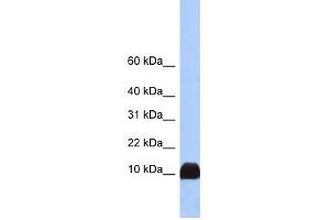 Profilin 1 antibody used at 1 ug/ml to detect target protein. (PFN1 Antikörper  (N-Term))