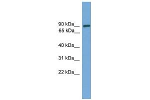 WB Suggested Anti-DEPDC1 Antibody Titration: 0. (DEPDC1 Antikörper  (Middle Region))