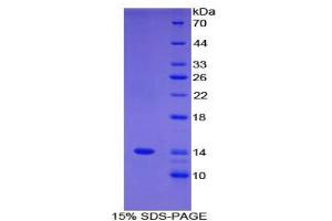 SDS-PAGE analysis of Human FAM19A3 Protein.