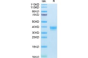 Human APLN on Tris-Bis PAGE under reduced condition. (Apelin Protein (APLN) (AA 23-77) (Fc Tag))