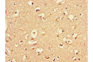 Immunohistochemistry of paraffin-embedded human brain tissue using ABIN7145523 at dilution of 1:100 (Nerve Growth Factor Antikörper  (AA 122-218))