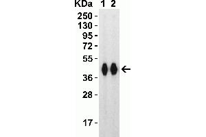 Western Blot Validation with SARS-CoV-2 (COVID-19) Spike RBD+SD1 Recombinant ProteinLoading: 30 ng per lane of SARS-CoV-2 (COVID-19) Spike RBD+SD1 recombinant protein, 10-304. (SARS-CoV-2 Spike Antikörper  (RBD))