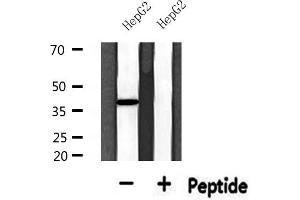 Western Blotting (WB) image for anti-Upstream Transcription Factor 2, C-Fos Interacting (USF2) (Internal Region) antibody (ABIN6265908)
