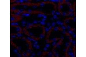 Immunofluorescence analysis of Mouse kidney tissue using TGF β Receptor II Polyclonal Antibody at dilution of 1:200. (TGFBR2 Antikörper)