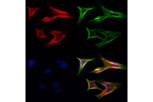 ABIN6264742 and ABIN6272414 staining Hela cells by IF/ICC.