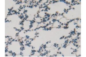 IHC-P analysis of Rat Lung Tissue, with DAB staining. (SFTPB Antikörper  (AA 111-329))