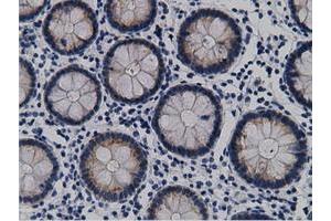 Immunohistochemical staining of paraffin-embedded Human Kidney tissue using anti-CRYM mouse monoclonal antibody. (CRYM Antikörper)