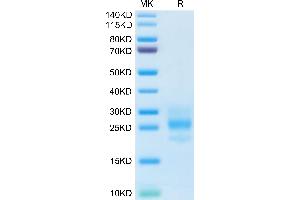 M-CSF/CSF1 Protein (AA 33-190)