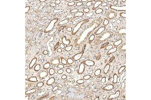 IHC analysis of SGCE using anti-SGCE antibody (ABIN7601544). (SGCE Antikörper  (AA 38-407))