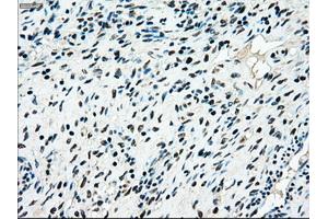 Immunohistochemical staining of paraffin-embedded colon tissue using anti-MAP2K4mouse monoclonal antibody. (MAP2K4 Antikörper)