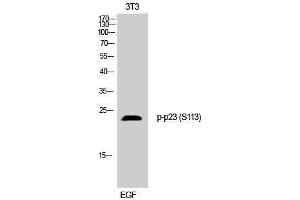 Western Blotting (WB) image for anti-Cyclin-Dependent Kinase 5, Regulatory Subunit 1 (p35) (CDK5R1) (pSer113) antibody (ABIN3179659) (CDK5R1 Antikörper  (pSer113))