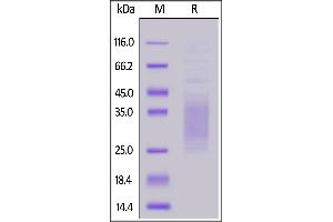 SDS-PAGE (SDS) image for Triggering Receptor Expressed On Myeloid Cells 2 (TREM2) (AA 19-171) (Active) protein (His tag) (ABIN7013566)
