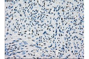 Immunohistochemical staining of paraffin-embedded endometrium tissue using anti-PORmouse monoclonal antibody. (POR Antikörper)