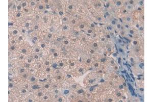 DAB staining on IHC-P; Samples: Human Liver Tissue (Thrombopoietin Antikörper  (AA 22-349))
