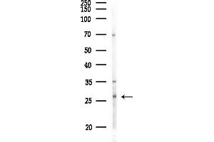 Western blot analysis of lysates from MDA-MB-231 cells(heat-shock,45 min treatment), using OAZ3 Antibody at 1/1000 dilution.