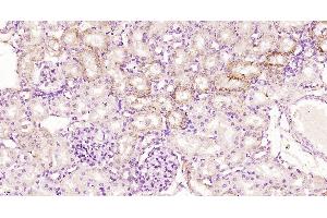 Paraformaldehyde-fixed, paraffin embedded Rat kidney, Antigen retrieval by boiling in sodium citrate buffer (pH6. (Kininogen-1 Light Chain Antikörper)