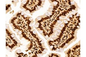 ABIN6260553 and ABIN6272990 at 1/100 staining Rat colon tissue by IHC-P. (AGTPBP1 Antikörper  (Internal Region))