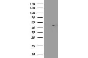 Western Blotting (WB) image for anti-SEC14-Like 2 (SEC14L2) antibody (ABIN1500854) (SEC14L2 Antikörper)