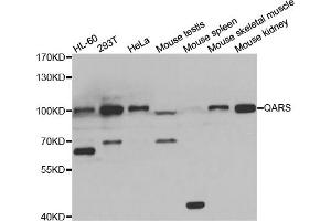 Western blot analysis of extracts of various cell lines, using QARS antibody (ABIN5974184) at 1/1000 dilution. (QARS Antikörper)