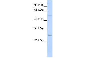 WB Suggested Anti-FTHL17 Antibody Titration:  0. (FTHL17 Antikörper  (N-Term))