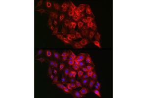 Immunofluorescence (IF) image for anti-Proteasome (Prosome, Macropain) 26S Subunit, Non-ATPase, 8 (PSMD8) (AA 101-350) antibody (ABIN6146347)