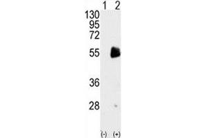 Western blot analysis of PRMT7 antibody and 293 cell lysate either nontransfected (Lane 1) or transiently transfected with the PRMT7 gene (2). (PRMT7 Antikörper  (AA 660-692))