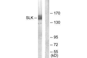 Western blot analysis of extracts from COLO205 cells, using SLK antibody. (SLK Antikörper  (C-Term))