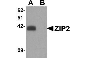 Western Blotting (WB) image for anti-Solute Carrier Family 39 (Zinc Transporter), Member 2 (Slc39a2) (N-Term) antibody (ABIN1031682) (ZIP2 Antikörper  (N-Term))