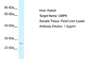 Host: Rabbit Target Name: CMPK Sample Tissue: Human Fetal Liver Antibody Dilution: 1ug/ml