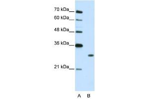 MBNL1 antibody used at 2. (MBNL1 Antikörper)