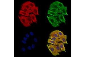 DPP9 - Catalytic domain Antibody staining Hela cells by IF/ICC. (DPP9 Antikörper  (Catalytic Domain, Internal Region))