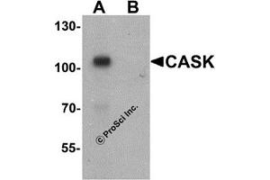 Western Blotting (WB) image for anti-Calcium/calmodulin-Dependent serine Protein Kinase (MAGUK Family) (CASK) (N-Term) antibody (ABIN1031293) (CASK Antikörper  (N-Term))