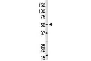 Image no. 1 for anti-Growth Differentiation Factor 9 (GDF9) (AA 37-67), (N-Term) antibody (ABIN357463)