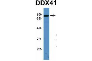 Host:  Rabbit  Target Name:  DDX41  Sample Type:  Human Fetal Lung  Antibody Dilution:  1. (DDX41 Antikörper  (N-Term))
