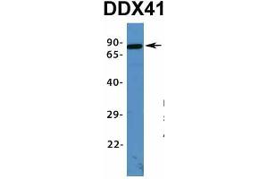 Host:  Rabbit  Target Name:  DDX41  Sample Type:  Human Fetal Lung  Antibody Dilution:  1.