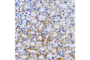 Immunohistochemistry (IHC) image for anti-Cytochrome P450, Family 24, Subfamily A, Polypeptide 1 (CYP24A1) (AA 36-448) antibody (ABIN1679472)