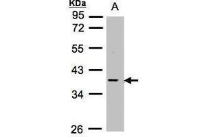 WB Image Sample (30μg whole cell lysate) A:Raji , 10% SDS PAGE antibody diluted at 1:1000 (MCL-1 Antikörper  (Center))