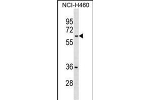 MDH1B Antibody (Center) (ABIN1538277 and ABIN2849269) western blot analysis in NCI- cell line lysates (35 μg/lane). (MDH1B Antikörper  (AA 304-332))