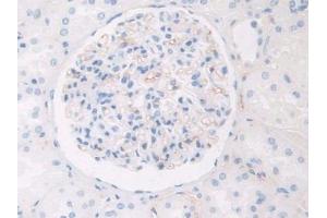 Used in DAB staining on fromalin fixed paraffin- embedded kidney tissue (HPR Antikörper  (AA 30-85))