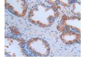 IHC-P analysis of Human Prostate Gland Tissue, with DAB staining. (CRP Antikörper  (AA 17-224))